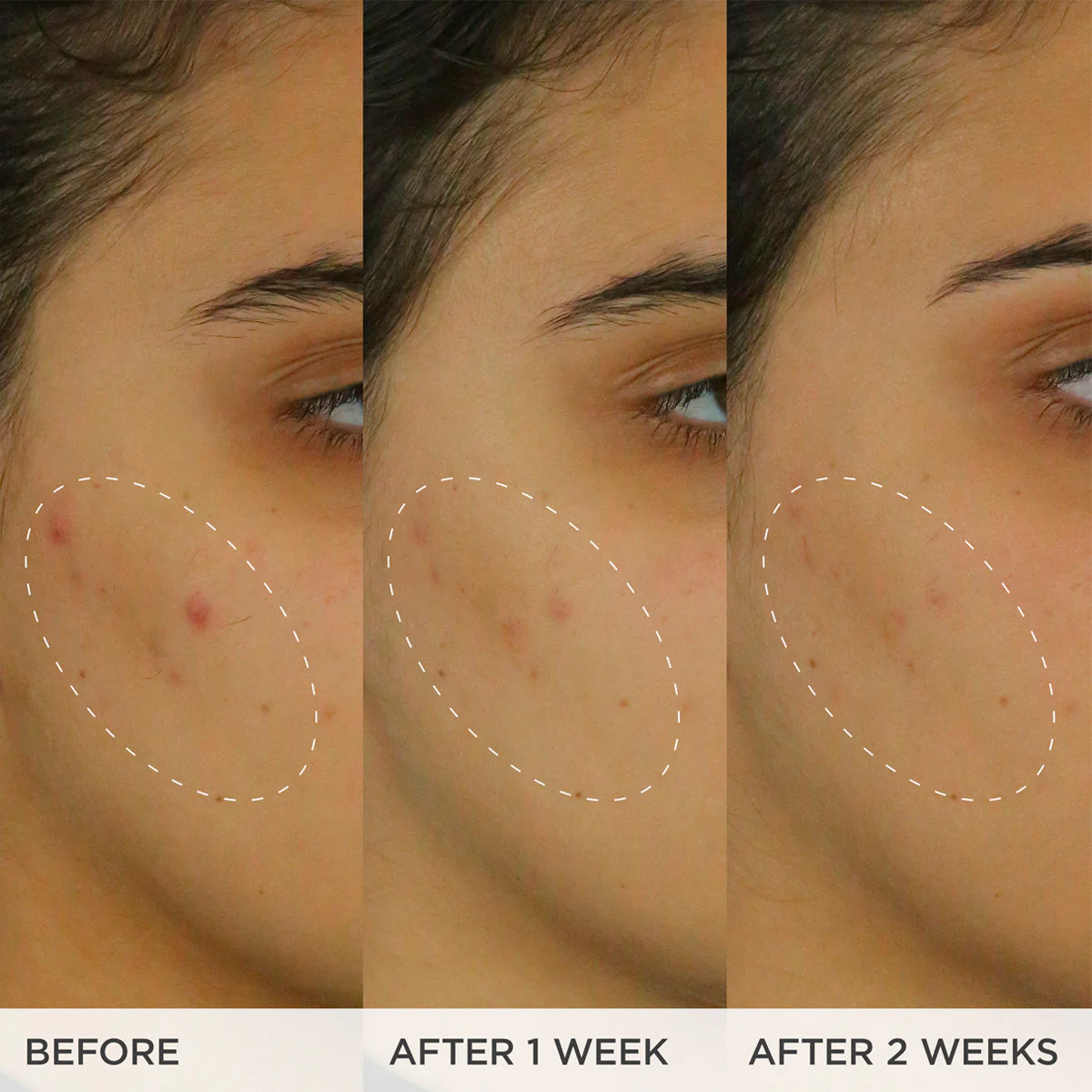 The Brightening Serum - Image 4